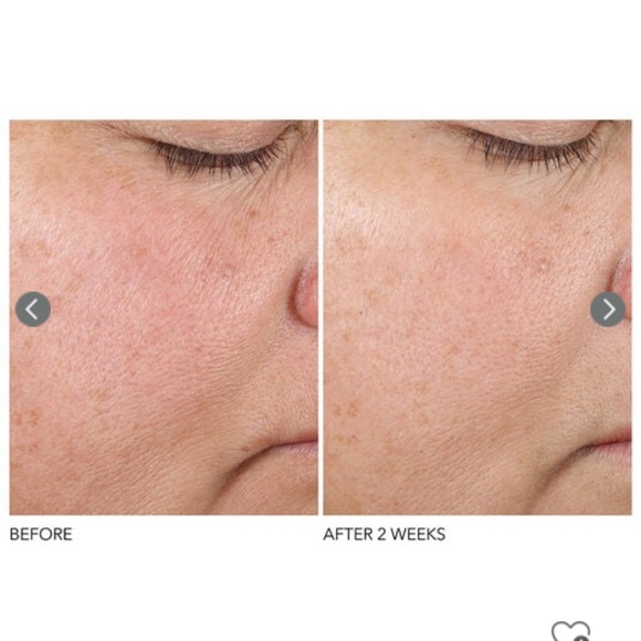 Dr Dennis gross texture renewal serum - Picture 3 of 6